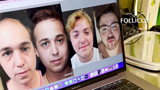 Case Study 9 - Transgender Transformations