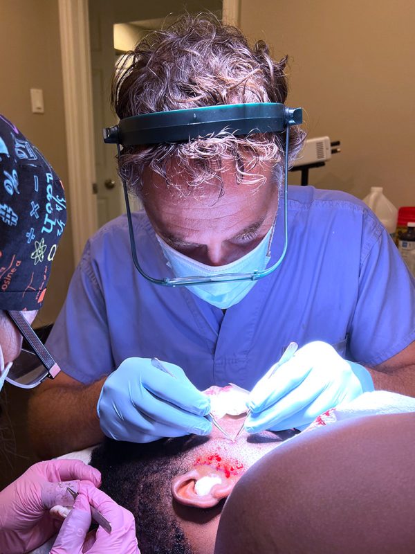 Beard and mustache restoration