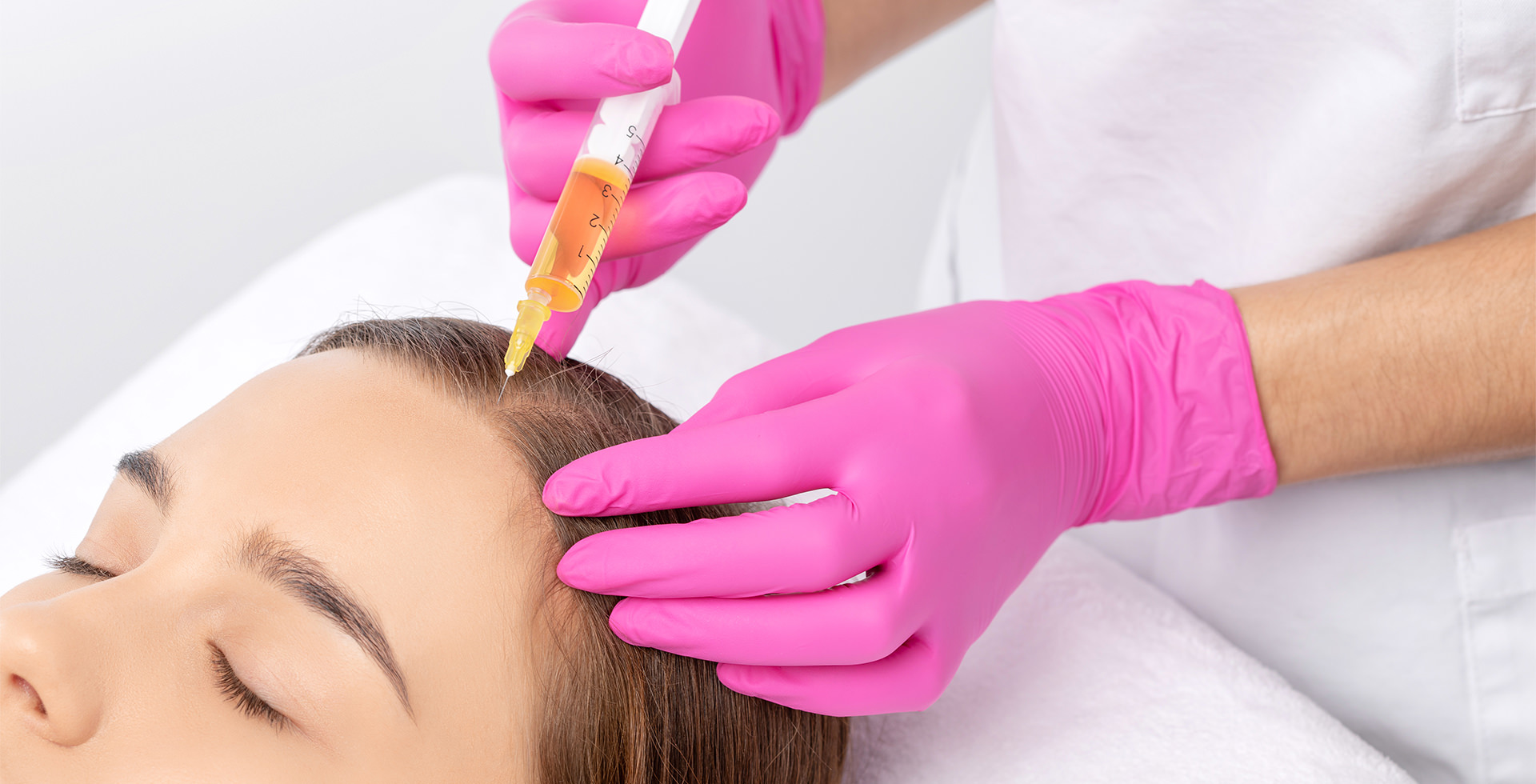 PRP Injections Hair Loss Treatment Restoration Toronto prp-injections-hair-loss-treatment-restoration-toronto