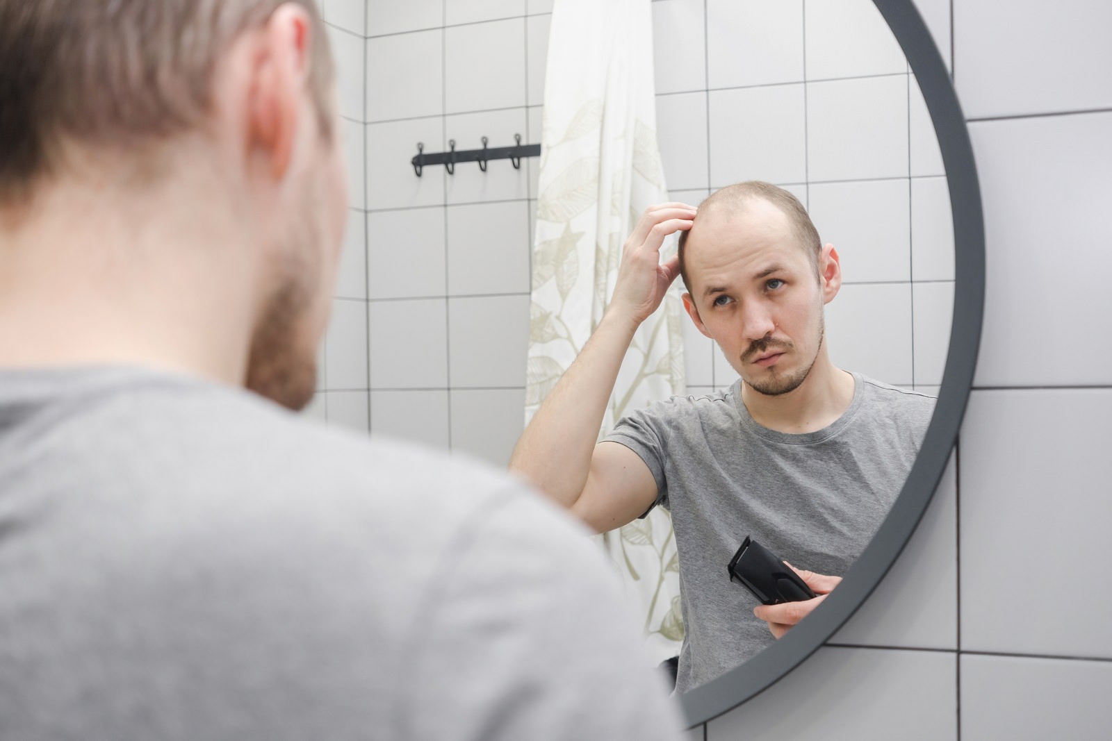 Why Is My Hair Thinning in My 20s?