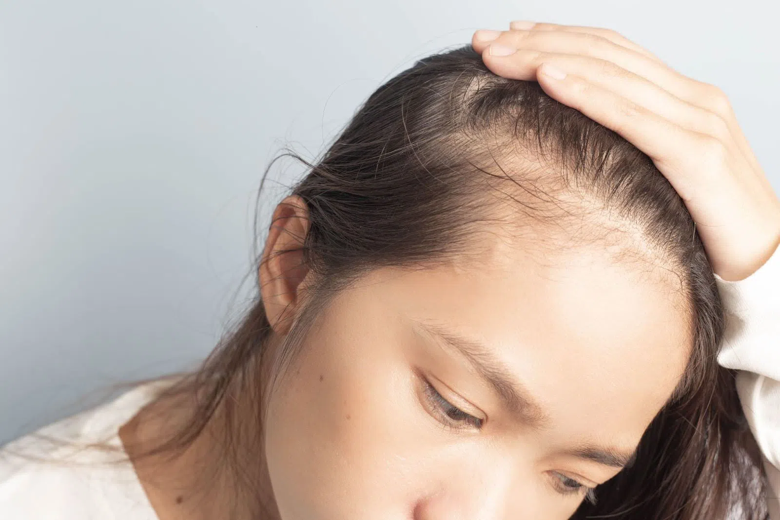 Am I a Good Candidate for a Hair Transplant?