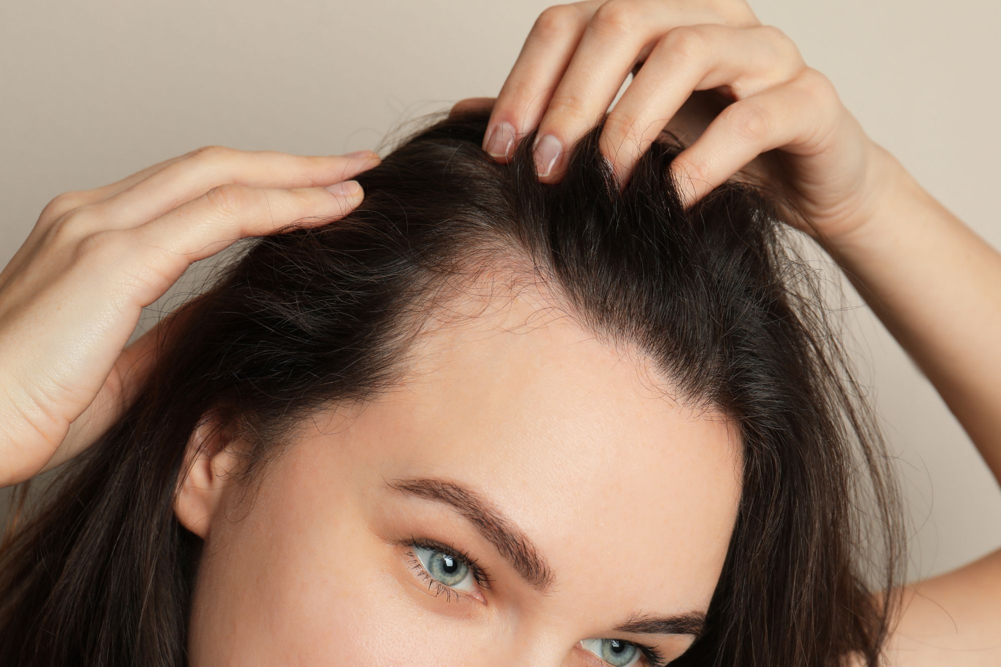 Hairline Lowering