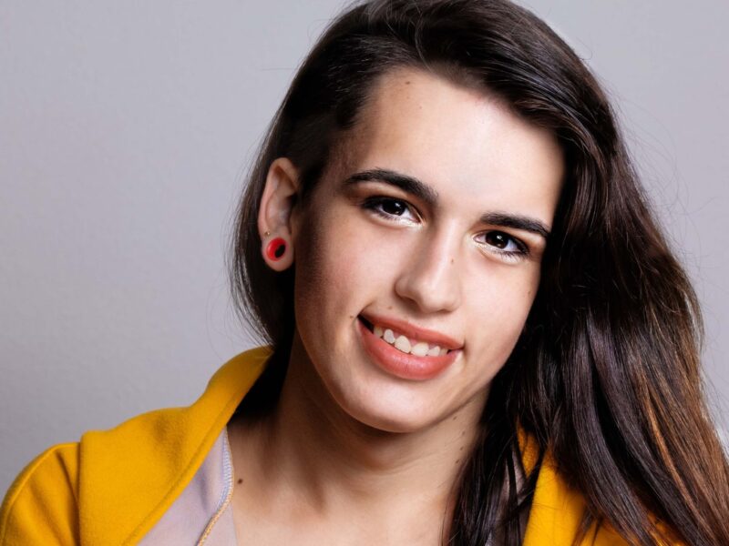 Transgender Feminization Hair Transplant in Toronto