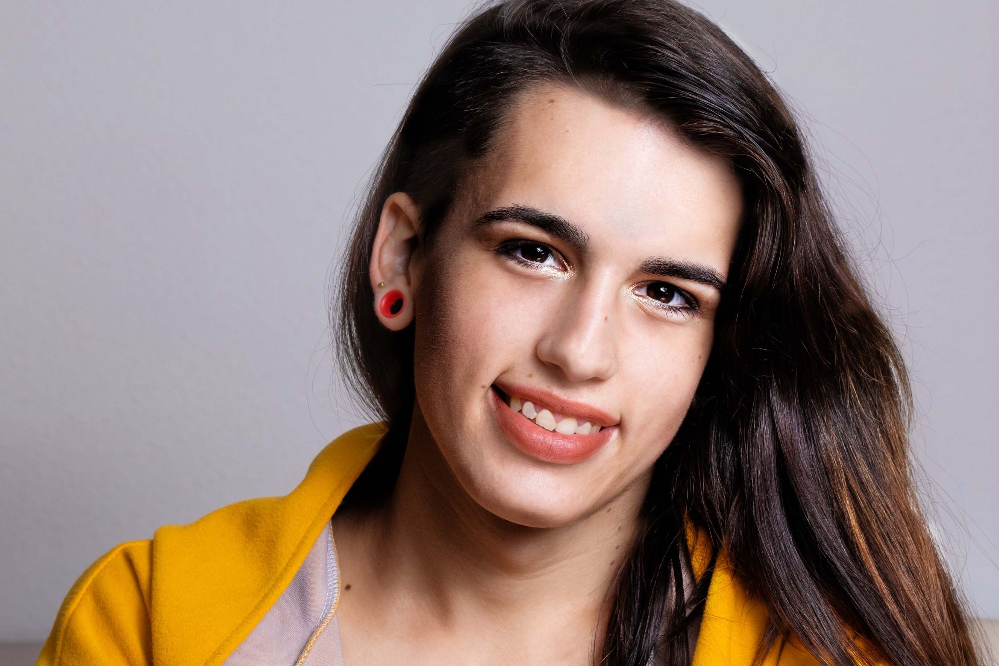 Transgender Feminization Hair Transplant in Toronto